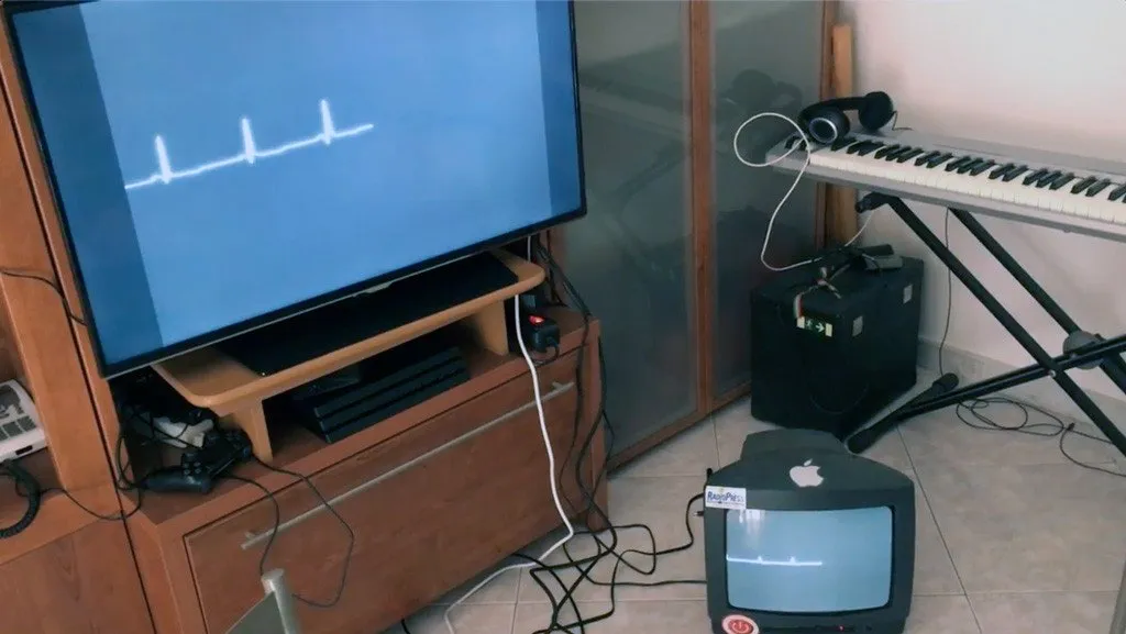 An early prototype